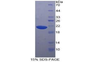 SDS-PAGE analysis of Human Hornerin Protein. (HRNR 蛋白)