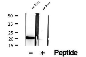 Western blot analysis of extracts of rat liver tissue, using CNPY2,MSAP antibody. (CNPY2/MSAP 抗体  (C-Term))