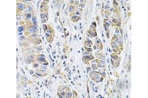Immunohistochemistry (Paraffin-embedded Sections) (IHC (p)) image for anti-VAMP (Vesicle-Associated Membrane Protein)-Associated Protein B and C (VAPB) antibody (ABIN7261311)