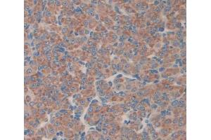 Used in DAB staining on fromalin fixed paraffin- embedded Kidney tissue (MTA1 抗体  (AA 6-218))