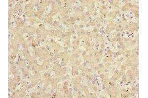 Immunohistochemistry of paraffin-embedded human liver tissue using ABIN7157720 at dilution of 1:100 (KLF15 抗体  (AA 1-260))