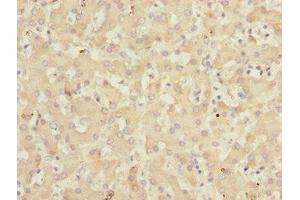 Immunohistochemistry of paraffin-embedded human liver tissue using ABIN7157720 at dilution of 1:100 (KLF15 抗体  (AA 1-260))