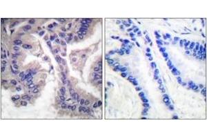 Immunohistochemistry (IHC) image for anti-Caspase 6, Apoptosis-Related Cysteine Peptidase (CASP6) (AA 144-193), (Cleaved-Asp162) antibody (ABIN1536083)