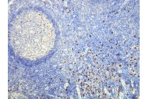 Immunohistochemistry (IHC) image for anti-lambda Light Chain (Lambda-IgLC) (AA 50-68), (N-Term) antibody (ABIN870374) (Lambda-IgLC 抗体  (N-Term))