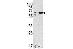 Western blot analysis of Beclin in 293 lysate transiently transfected with the BECN1 gene (2ug/lane). (Beclin 1 抗体  (AA 210-239))