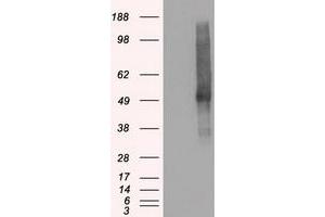 HEK293T cells were transfected with the pCMV6-ENTRY control (Left lane) or pCMV6-ENTRY SLC18A2 (Right lane) cDNA for 48 hrs and lysed. (SLC18A2 抗体)