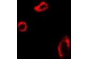 Immunofluorescent analysis of UROD staining in U2OS cells. (UROD 抗体)