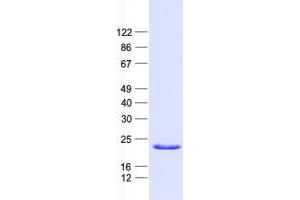 Western Blotting (WB) image for BCL2-Interacting Killer (Apoptosis-Inducing) (BIK) protein (His tag) (ABIN2715266)