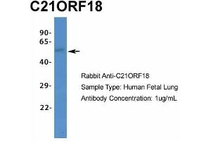 Host:  Rabbit  Target Name:  C21ORF18  Sample Type:  Human Fetal Lung  Antibody Dilution:  1. (SETD4 抗体  (C-Term))