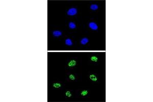 Confocal immunofluorescent analysis of p73 antibody with 293 cells followed by Alexa Fluor 488-conjugated goat anti-rabbit lgG (green). (Tumor Protein p73 抗体  (AA 288-317))