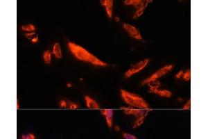 Immunofluorescence analysis of U-2 OS cells using LRRC7 Polyclonal Antibody at dilution of 1:100. (LRRC7 抗体)