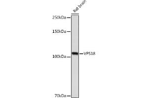 Western blot analysis of extracts of Rat brain, using VPS18 Rabbit mAb (ABIN7271274) at 1:1000 dilution. (VPS18 抗体)