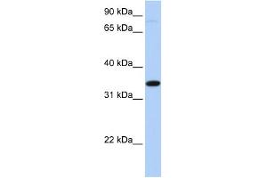 WB Suggested Anti-SLC44A3 Antibody Titration:  0. (SLC44A3 抗体  (Middle Region))