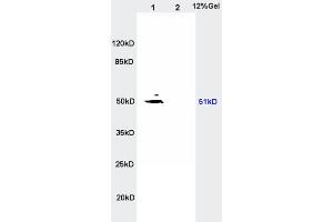 L1 rat kidney lysates, L2 rat brain lysates probed with Anti- SLC16A3/MCT4 Polyclonal Antibody, Unconjugated  at 1:200 in 4˚C. (SLC16A3 抗体  (AA 401-465))