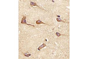 (ABIN6242187 and ABIN6577955) staining PH in Human brain tissue sections by Immunohistochemistry (IHC-P - paraformaldehyde-fixed, paraffin-embedded sections). (Amphiphysin 抗体  (AA 336-370))