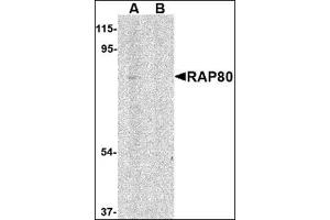 Western blot analysis of RAP80 in 293 cell lysate in (A) the absence and (B) presence of blocking peptide with this product at 1 μg/ml. (UIMC1 抗体  (N-Term))