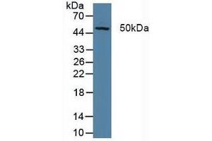 Detection of XPG in Porcine Liver Tissue using Polyclonal Antibody to Xeroderma Pigmentosum, Complementation Group G (XPG) (ERCC5 抗体  (AA 778-986))