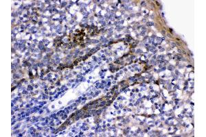 LFA3 was detected in paraffin-embedded sections of human tonsil tissues using rabbit anti- LFA3 Antigen Affinity purified polyclonal antibody (Catalog # ) at 1 µg/mL. (CD58 抗体  (AA 29-215))