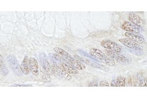 Immunohistochemistry (IHC) image for anti-Tripartite Motif Containing 33 (TRIM33) (C-Term) antibody (ABIN7448843) (TRIM33 抗体  (C-Term))