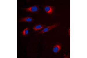 Immunofluorescent analysis of GPR18 staining in H9C2 cells. (GPR18 抗体  (Center))