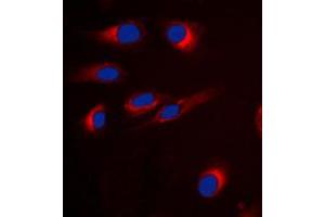 Immunofluorescent analysis of GPR18 staining in H9C2 cells.