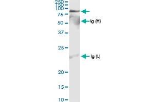Immunoprecipitation of IDS transfected lysate using anti-IDS MaxPab rabbit polyclonal antibody and Protein A Magnetic Bead , and immunoblotted with IDS MaxPab rabbit polyclonal antibody (D01) . (IDS 抗体  (AA 1-550))