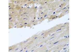 Immunohistochemistry of paraffin-embedded Rat heart using RAB24 Polyclonal Antibody at dilution of 1:100 (40x lens). (RAB24 抗体)