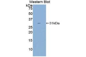 Western Blotting (WB) image for anti-Cytochrome P450, Family 21, Subfamily A, Polypeptide 2 (CYP21A2) (AA 37-264) antibody (ABIN3206433) (CYP21A2 抗体  (AA 37-264))
