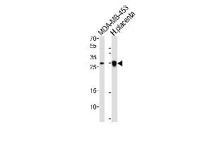 Western blot analysis of lysates from MDA-MB-453 cell line, human placenta tissue lysate (from left to right), using FOLR2 Antibody at 1:1000 at each lane. (FOLR2 抗体  (N-Term))