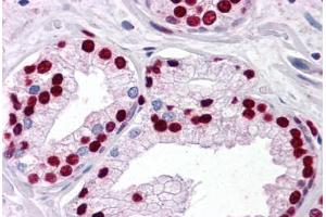 Human Prostate: Formalin-Fixed, Paraffin-Embedded (FFPE) (SMAD6 抗体  (AA 285-385))