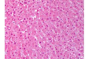 Anti-SOD1 antibody IHC of human liver, hephatocytes.