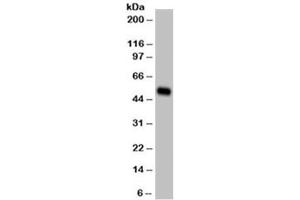 Western blot testing of A431 cell lysate (epidermoid carcinoma) and Cytokeratin 14 antibody (clone LL002) at 1ug/ml.