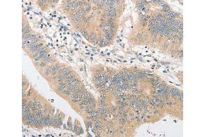 Immunohistochemistry (IHC) image for anti-Toll-Like Receptor 4 (TLR4) antibody (ABIN2422732) (TLR4 抗体)