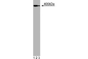 Western Blotting (WB) image for anti-Utrophin (UTRN) (AA 768-874) antibody (ABIN968237) (Utrophin 抗体  (AA 768-874))