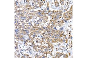 Immunohistochemistry (IHC) image for anti-Signal Recognition Particle 72kDa (SRP72) antibody (ABIN6134166)