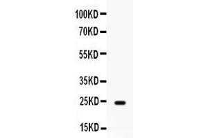 Western blot analysis of FGF1 expression in rat cardiac muscle extract ( Lane 1). (FGF1 抗体  (AA 16-155))
