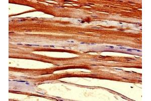 Immunohistochemistry of paraffin-embedded human skeletal muscle tissue using ABIN7172041 at dilution of 1:100 (TMX2 抗体  (AA 49-102))