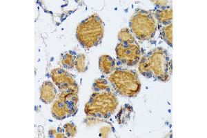 Immunohistochemistry of paraffin-embedded mouse thyroid using Thyroid Peroxidase Rabbit mAb (ABIN7270865) at dilution of 1:100 (40x lens). (TPO 抗体)