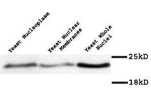 Western blot of Mad2p polyclonal antibody  on yeast preparation. (MAD2 抗体)