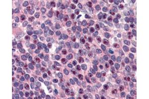 IHC testing of FFPE human spleen tissue with FANCG antibody at 3ug/ml. (FANCG 抗体)