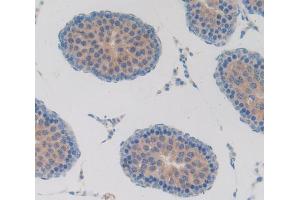 Used in DAB staining on fromalin fixed paraffin- embedded testis tissue (T-Bet 抗体  (AA 241-493))