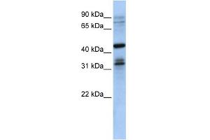WB Suggested Anti-MSI2 Antibody Titration:  0. (MSI2 抗体  (N-Term))