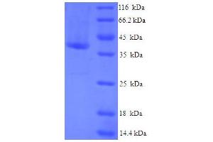 SDS-PAGE (SDS) image for CASP2 and RIPK1 Domain Containing Adaptor with Death Domain (CRADD) (AA 1-199), (full length) protein (His-SUMO Tag) (ABIN5709321) (CRADD Protein (AA 1-199, full length) (His-SUMO Tag))