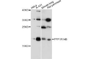 Western blot analysis of extracts of various cell lines, using PPP1R14B antibody (ABIN6294069) at 1:1000 dilution. (PPP1R14B 抗体)