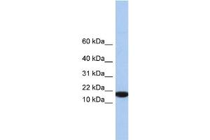 WB Suggested Anti-IL5 Antibody Titration: 0. (IL-5 抗体  (Middle Region))