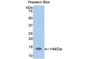 Western Blotting (WB) image for anti-CAP, Adenylate Cyclase-Associated Protein 1 (CAP1) (AA 38-149) antibody (ABIN1174519) (CAP1 抗体  (AA 38-149))
