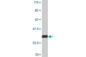 Western Blot detection against Immunogen (35.