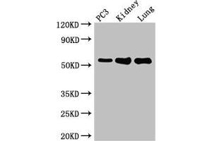 Western Blot Positive WB detected in: PC-3 whole cell lysate, Mouse kidney tissue, Mouse lung tissue All lanes: MMP13 antibody at 2 μg/mL Secondary Goat polyclonal to rabbit IgG at 1/50000 dilution Predicted band size: 54 kDa Observed band size: 54 kDa (MMP13 抗体  (AA 104-471))