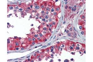 Immunohistochemistry (IHC) image for anti-Neuropeptide Y Receptor Y1 (NPY1R) (Middle Region) antibody (ABIN2777014) (NPY1R 抗体  (Middle Region))