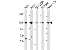 All lanes : Anti-DBN1 Antibody (Center) at 1:2000 dilution Lane 1: Hela whole cell lysate Lane 2: Jurkat whole cell lysate Lane 3: SH-SY5Y whole cell lysate Lane 4: mouse brain lysate Lane 5: Neuro-2a whole cell lysate Lysates/proteins at 20 μg per lane. (DBN1 抗体  (AA 194-228))
